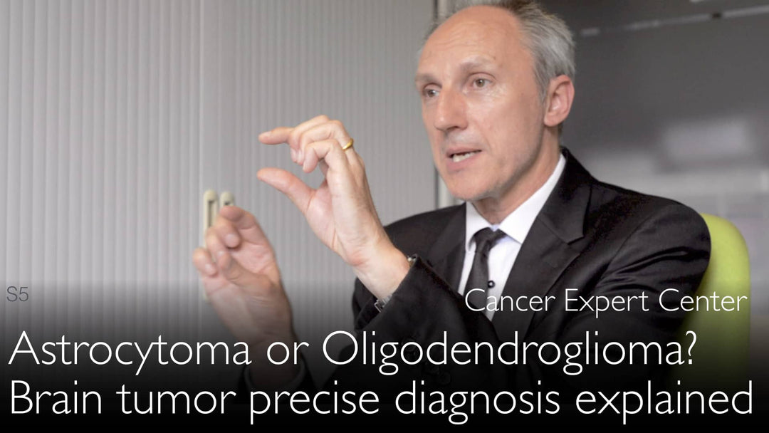 Astrocitoma u oligodendroglioma? Diagnóstico preciso de los tumores cerebrales. 4