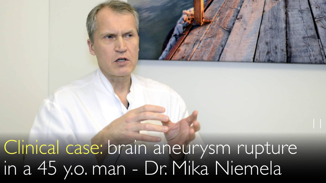 Ruptura de aneurisma cerebral en un varón de 45 años. Caso clínico. 11