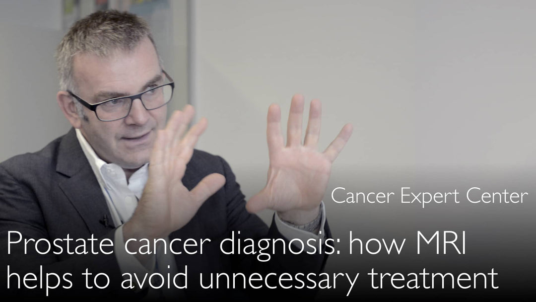 El sobrediagnóstico en el cáncer de próstata puede conducir a un tratamiento innecesario. 4