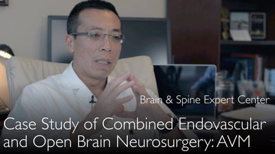 Aneurisma cerebral complejo 
 Tratamiento endovascular y cirugía cerebral abierta 
 Caso clínico 
 4