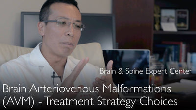Tratamiento de la malformación arteriovenosa cerebral. Terapia para la malformación arteriovenosa (MAV). 9