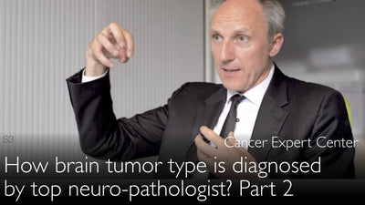 ¿Cómo diagnosticar el tipo de tumor cerebral? Un experto en neurooncología lo explica. Parte 2. 2