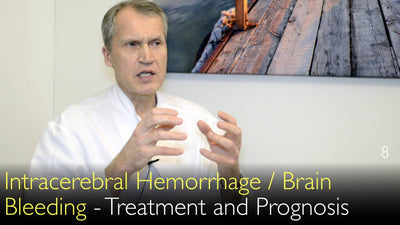 Hemorragia Intracerebral. Tratamiento y pronóstico del sangrado cerebral. 8