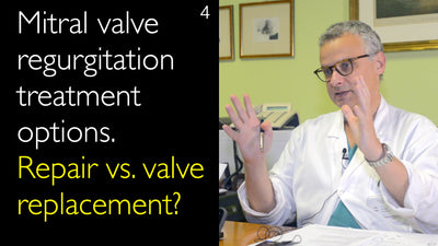 Opciones de tratamiento para la regurgitación mitral. ¿Reparación o sustitución valvular? 4
