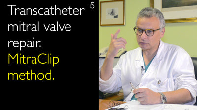 Reparación mitral transcatérmica. Método MitraClip. 5