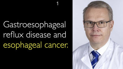 Enfermedad por reflujo gastroesofágico y cáncer de esófago. 1