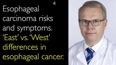 Carcinoma esofágico: riesgos y síntomas. Diferencias entre el ‘Este’ y el ‘Oeste’ en el cáncer de esófago. 4