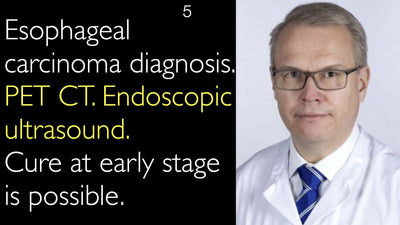 Carcinoma esofágico. Tomografía por emisión de positrones-tomografía computarizada (PET-TC). Ecografía endoscópica. La curación en estadio inicial es posible. 5