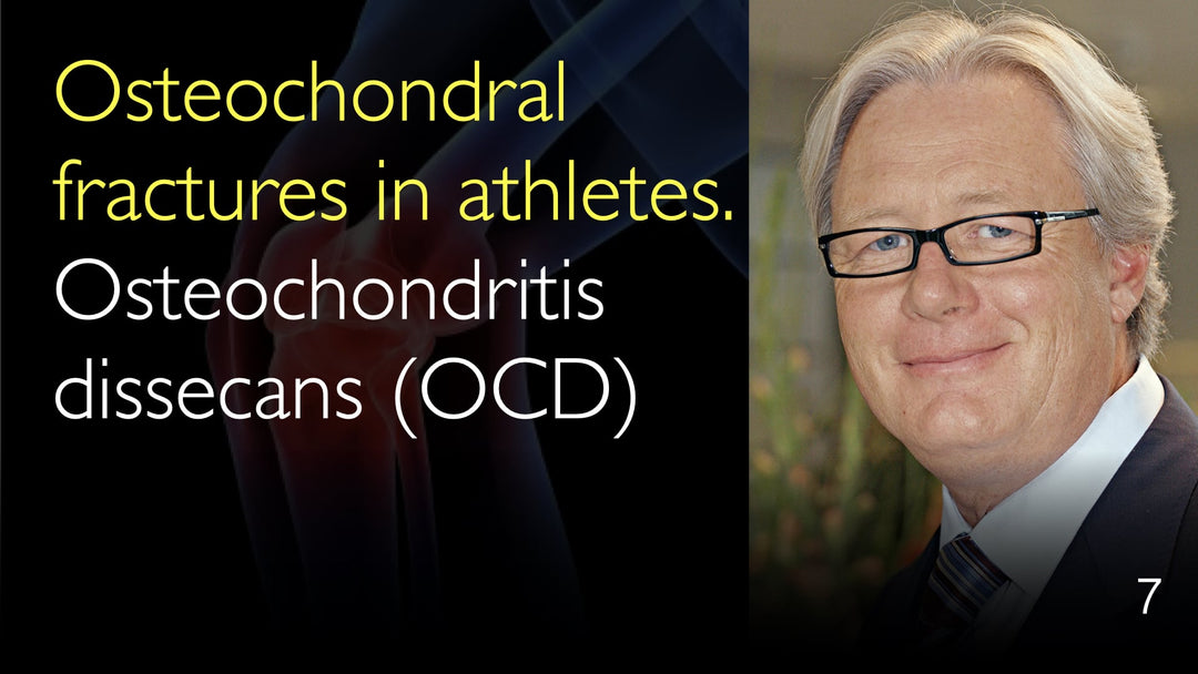 Fracturas osteocondrales en deportistas. TOCD, Osteocondritis disecante. 7