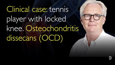 Caso clínico. Tenista con bloqueo de rodilla. Osteocondritis disecante (OCD). 9