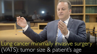 Cáncer de pulmón. Cirugía mínimamente invasiva. Resección del tumor pulmonar mediante cirugía torácica asistida por video. CTVA (Cirugía Torácica Asistida por Video). 2