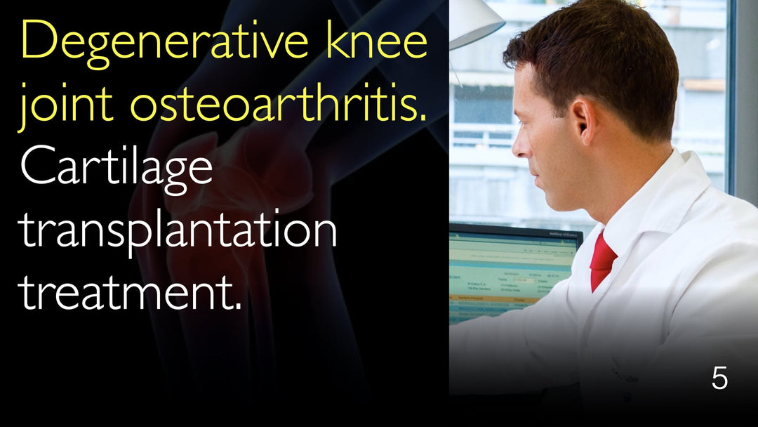 Osteoartritis degenerativa de la articulación de la rodilla. Tratamiento mediante trasplante de cartílago. 5
