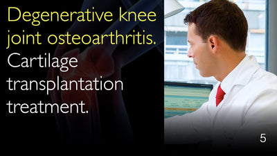 Osteoartritis degenerativa de la articulación de la rodilla. Tratamiento mediante trasplante de cartílago. 5
