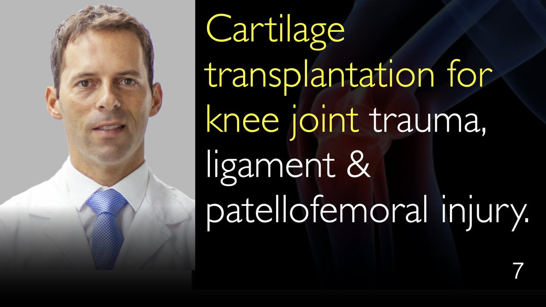 Trasplante de cartílago para traumatismo de la articulación de la rodilla, lesión ligamentosa y patelofemoral. 7