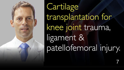Trasplante de cartílago para traumatismo de la articulación de la rodilla, lesión ligamentosa y patelofemoral. 7