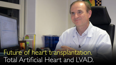 Futuro del trasplante cardíaco. Dispositivo de Asistencia Ventricular Izquierda, DAVI (LVAD). Corazón Artificial Total, CAT (TAH). 10