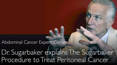 Tratamiento del cáncer peritoneal metastásico. Quimioterapia intraperitoneal hipertérmica (HIPEC). Quimioterapia intraperitoneal precoz (EPIC). Procedimiento de Sugarbaker. 5