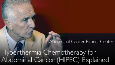 Quimioterapia Hipertérmica para el Cáncer Peritoneal. ¿Por qué aplicar calor? Quimioterapia Intraperitoneal Hipertérmica (HIPEC). 6
