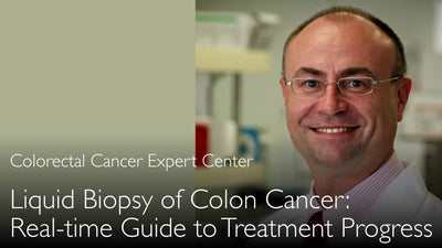 Biopsia líquida del cáncer de colon. Cómo monitorizar el tratamiento oncológico de forma continua. 5