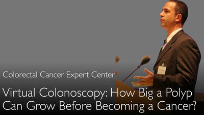 ¿Qué tamaño puede alcanzar un pólipo de colon antes de que se convierta en cáncer? ¿Qué es un "adenoma plano"?